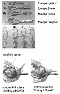 porodnické kleště