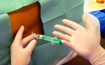 Kombinovaná subarachnoidální a epidurální analgezie - obrázek